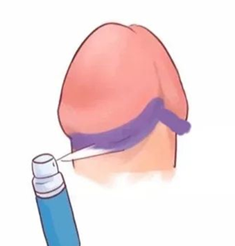 喷剂问题合集：（1）喷剂使用教程